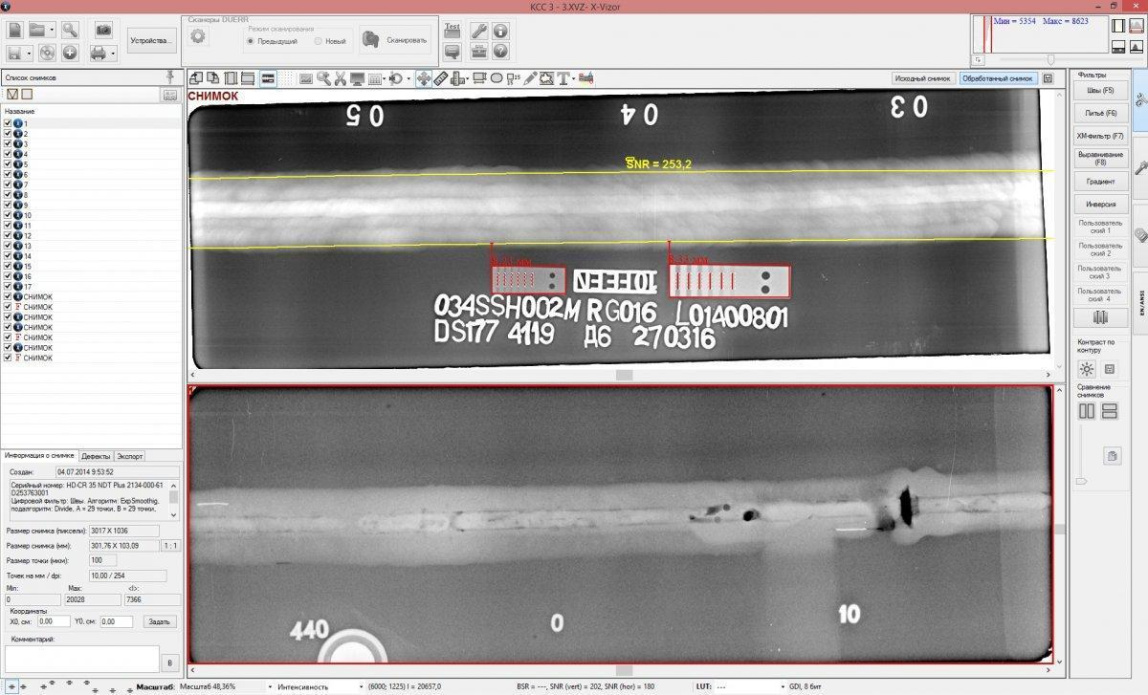 АПК КАРАТ РС35a оцифровщик рентгеновских плёнок - 1