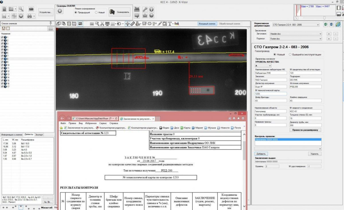 АПК КАРАТ РС35a оцифровщик рентгеновских плёнок - 3