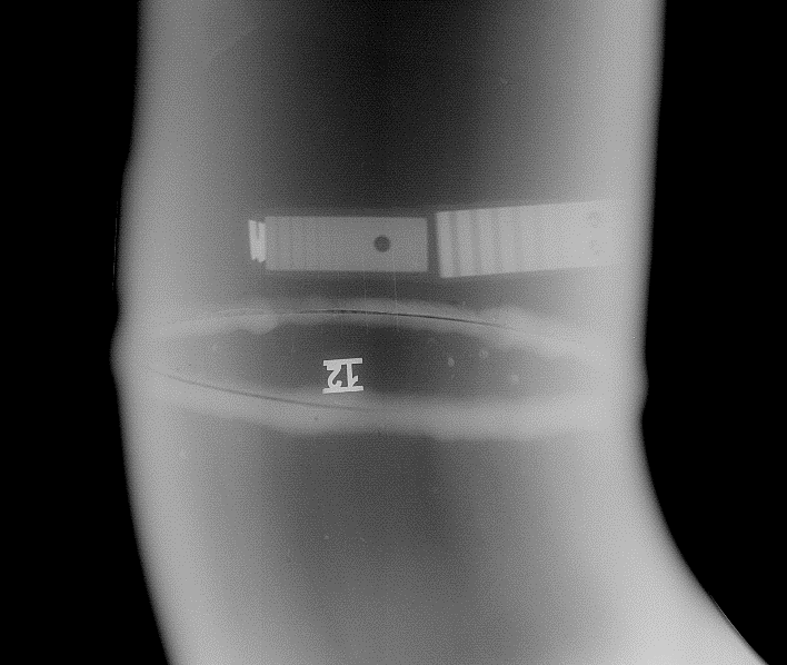 БеРКУТ 0605-50 цифровой радиографический программно-аппаратный комплекс - 2